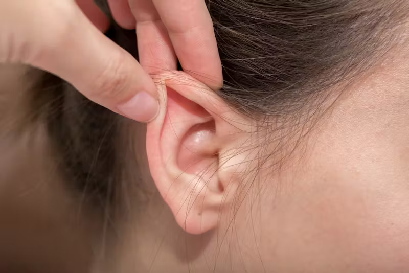 Ear Reshaping (Otoplasty) Steps, Advantages and Benefits