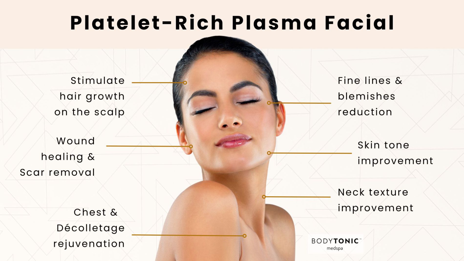 What is PRP?