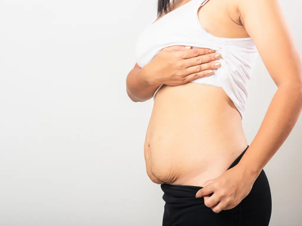 What is gastric by pass surgery and Who is eligible for gastric by pass surgery?
