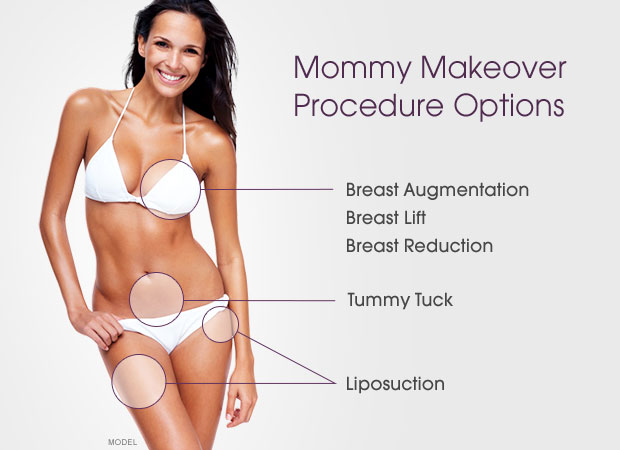 Mommy Makeover Steps, Advantages and Benefits