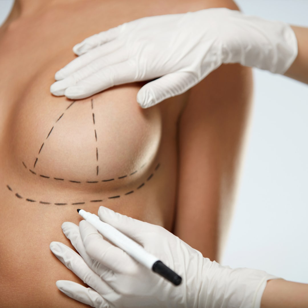 Breast Lift img